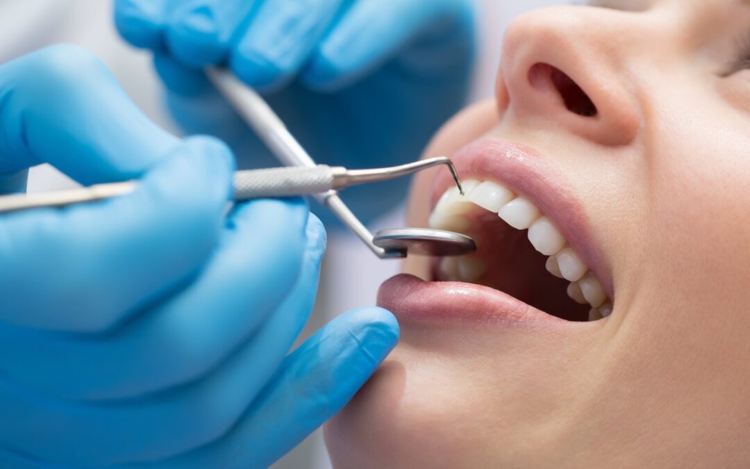 Preventie Dentara