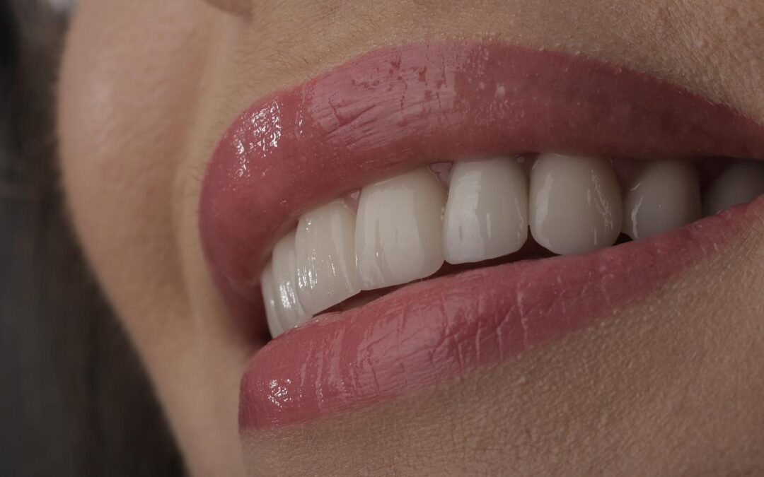 Ce proceduri de estetică dentară poți alege în funcție de nevoile zâmbetului tău?
